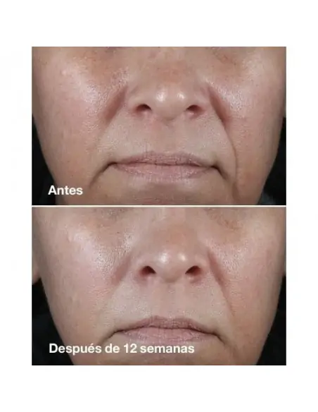 Smart Clinical Repair Wrinkle Correcting Rich Cremas Antiarrugas