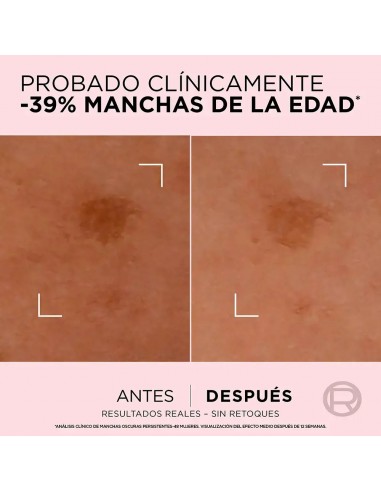 L'Oréal Paris Age Perfect Sérum Corrector Anti-Manchas 30 ml
